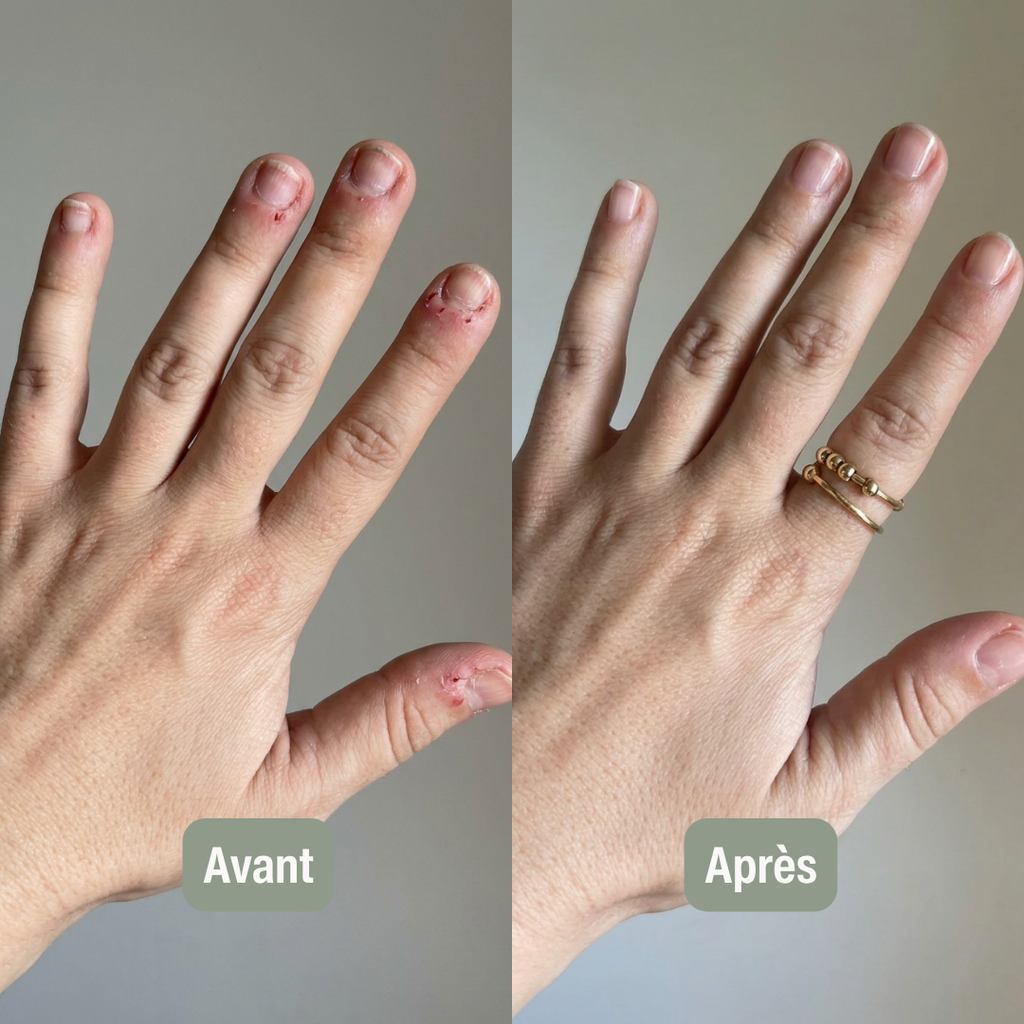 Bague anti-anxiété à billes mobiles